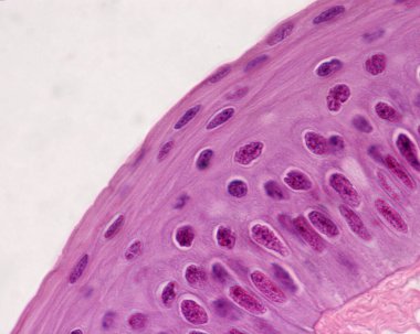 Kornea epitelyumunun mikroskop mikroskobu. Gözün korneası ince, katmanlaşmamış skuamöz epitelyumla kaplı. En derin katmanın hücreleri sütundur, sonra iki ya da üç katmanlı polihedral vardır.