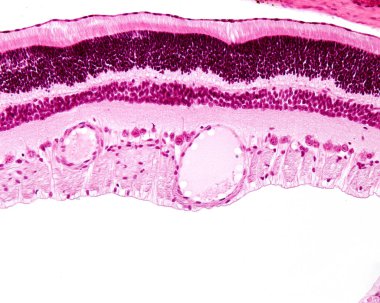 Retina katmanları, hafif mikrograf. Tepeden tırnağa: pigment epitelyum, çubuklar ve koniler, dış nükleer, dış pleksi, iç nükleer, iç pleksi, sinir hücresi ve sinir lifleri. Ganglion hücresinde genişlemiş bir damar ve bir damar görünüyor.