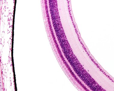 Işık mikroskobu retina katmanlarını gösteriyor. Soldan sağa doğru retina katmanları şunlardır: pigment epitelyum katmanı (koroide bağlanmış ve retinanın geri kalanından ayrılmış), çubuk ve koni katmanı, dış nükleer katman, dış katman, iç katman, 