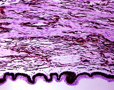 - İnsan vücudu. Yukarıdan bakıldığında, kan damarlarını, melanin tanecikleriyle dolu pigmentli hücreleri ve silivri kasa ait pürüzsüz kas liflerini gösteren siliyer. Dipte, birkaç silisyum işlemi çift epitle sıralanır.