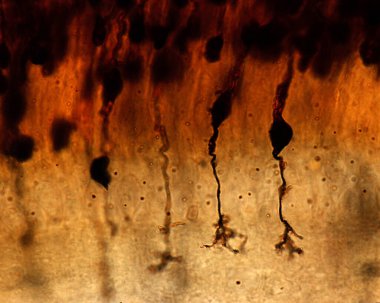 Golgi metodu ile lekelenmiş bir retinanın yüksek büyütme ışık mikroskobu ovoid hücreli iki bipolar hücreyi ve bir iç süreci (akson) göstermektedir.