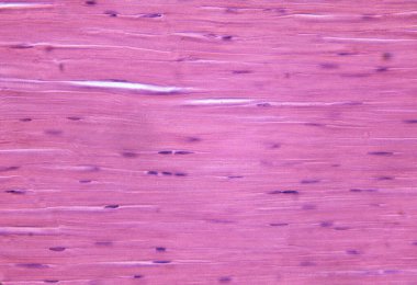 Gözün korneasının hafif mikrografı kolajen lifleri ve ara spermli keratositlerle kornea stromasını gösteriyor..