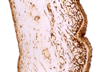 Lekelenmemiş bir irinin ışık mikrografı pigment hücrelerinin yerini gösteriyor. Melanin pigmenti iris stroma 'nın arka yüzeyinde, pigment epitelyumun (sağda) yanında yoğunlaşmıştır. İkisinin arasında açık bir şerit var. 