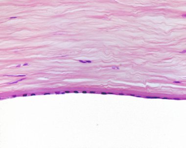 Göz korneasının iç katmanları gösteriyor ki, tepeden tırnağa kolajen lifleri ve interspermlenmiş keratositlerle kornea stroması, kalın bir Descemet zarı ve çok ince bir endothelium..