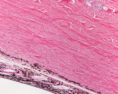 Işık mikroskobu mikroskobu sklera (üstte) ve koroit (altta) arasındaki sınırı gösteriyor. Skleranın iç katmanı pigmentli hücrelere sahiptir (lamina fusca veya suprachoroid lamina).