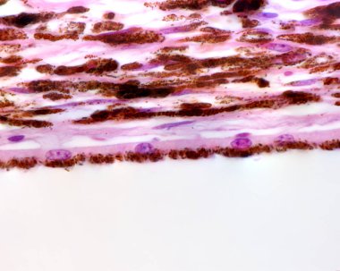 Kan damarları ve pigment hücreleri, koriyokılcal damarlar (tek bir kan katmanı) ve retinal pigment epitelyum (epitelyum) ile göz küresindeki koroit stromanın hafif mikrografisi göstermektedir..