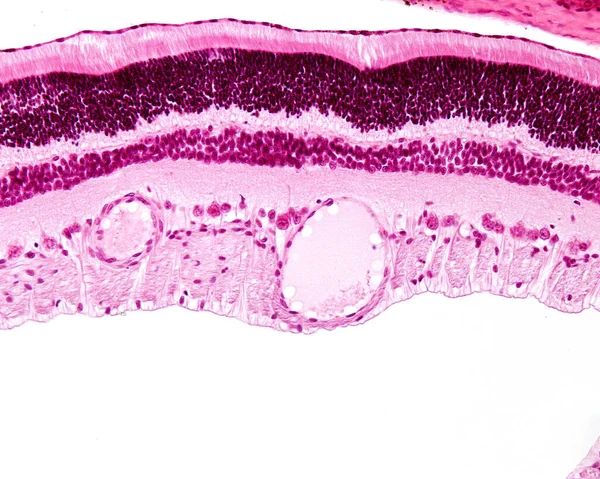 Retina layers, light micrograph. From top to bottom: pigment epithelium, rods and cones, outer nuclear, outer plexiform, inner nuclear, inner plexiform, ganglion cell, and nerve fibre layers. A dilated artery and a vein appear in the ganglion cell la