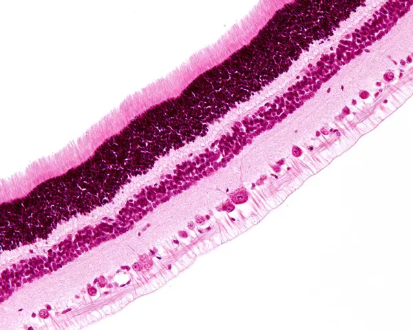 Retina layers, light micrograph. From top to bottom: rods and cones, outer nuclear, outer plexiform, inner nuclear, inner plexiform, ganglion cell, and nerve fibre layers.