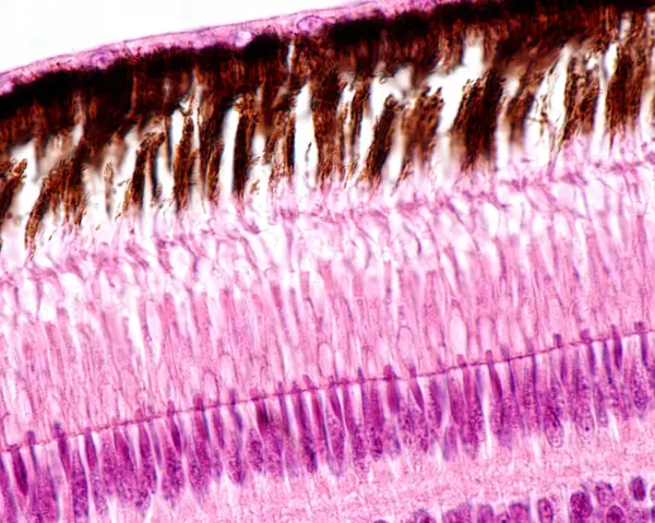 High magnification light micrograph showing the outer layers of the retina of a bird. From top to bottom: pigment epithelium layer with processes full of melanin granules, rod and cones layer, external limiting membrane, outer nuclear layer.