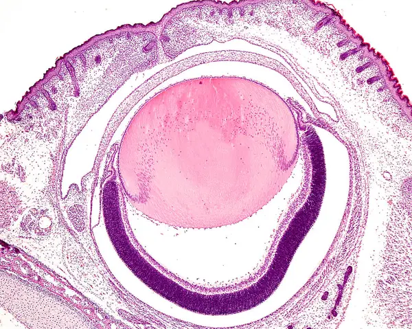 Very low magnification light microscope micrograph of the eye of an albino rat embryo showing, from top to bottom: fused eyelids with developing hair follicles, cornea, anterior chamber, lens flanked by a short iris (retracted) and developing retina