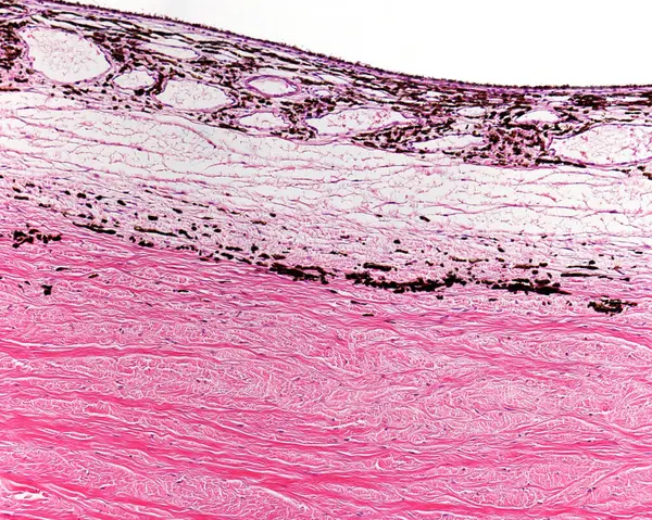 Light microscope micrograph showing the limit between sclera (bottom) and choroid (top). The inner layer of sclera has pigmented cells (lamina fusca or suprachoroid lamina).
