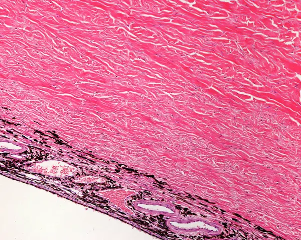 Light microscope micrograph showing, from top, the dense connective tissue of sclera, the lamina fusca where pigmented cells appear among collagen fibers, and the choroid, with many blood vessels and pigment cells.