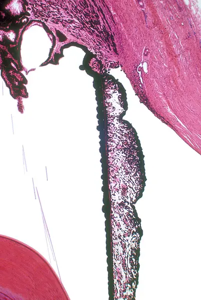 Very low magnification light microscope micrograph showing, from right to left: cornea, anterior chamber angle (with trabecular meshwork), iris, ciliary body, some zonule fibers and lens.
