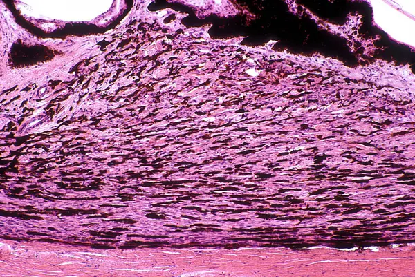 Cross sectioned ciliary body, resting on the sclera (bottom), showing the typical triangular shape due to ciliary muscle. The smooth muscle fibers of ciliary muscle are surrounded by a stroma with many pigmented cells. On top border, the pigmented ep