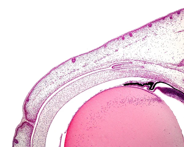 Light microscope micrograph of the developing eye of a cat embryo showing, from top to bottom: fused eyelids, anterior chamber, cornea and posterior chamber.
