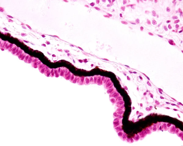 The ciliary body is lined by a double-layered epithelium. This high magnification micrograph clearly shows this double layer: an inner non-pigmented layer and an outer heavily pigmented layer.