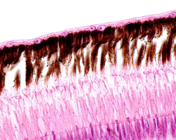 High magnification light micrograph showing the outer layers of the retina of a bird. From top to bottom: pigment epithelium layer with processes full of melanin granules, rod and cones layer, external limiting membrane, outer nuclear layer.