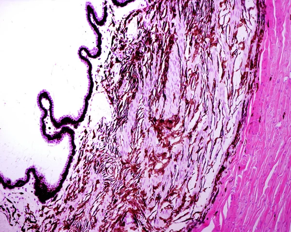 Ciliary body showing, from right to left, dense connective tissue of sclera, ciliary body stroma showing blood vessels, pigmented cells full of melanin granules, and many fascicles of smooth muscle fibers belonging to ciliary muscle, and a double epi