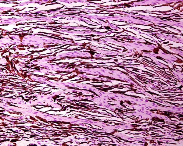 The ciliary muscle is an intrinsic muscle of the eye forming a ring of smooth muscle fibers in the eye\'s uvea. It controls accommodation for viewing objects at varying distances changing the shape of the lens. The micrograph shows many fascicles of s