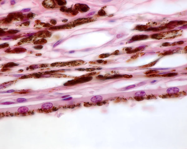 High magnification micrograph showing, from top, the choroid stroma with blood vessels and pigment cells, the choriocapillaris (a single layer of blood capillaries), and retinal pigment epithelium.