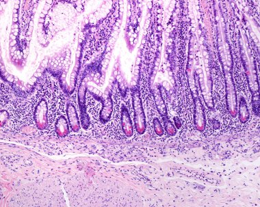 Fare dalağının düşük büyütme mikrografı asit fosfataz tespiti için histokimyasal teknikle lekelenmiş. Bu teknikle, makrofajlar kahverengidir. Kırmızı hamurda yüksek oranda makrofaj var.
