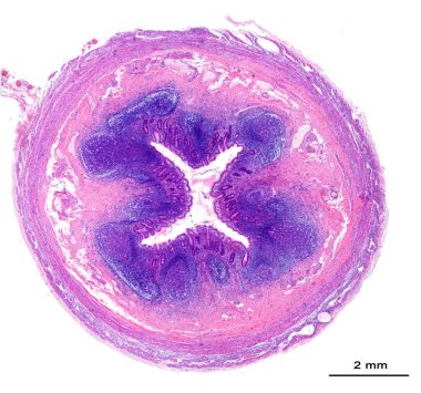 Fare dalağının düşük büyütme mikrografı asit fosfataz tespiti için histokimyasal teknikle lekelenmiş. Bu teknikle, makrofajlar kahverengidir. Kırmızı hamurda yüksek oranda makrofaj var.