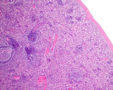 Fare dalağının düşük büyütme mikrografı asit fosfataz tespiti için histokimyasal teknikle lekelenmiş. Bu teknikle, makrofajlar kahverengidir. Kırmızı hamurda yüksek oranda makrofaj var.