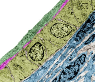 Coloured transmission electron micrograph (TEM) of a small arteriole showing, from lumen: endothelium (magenta), discontinuous internal elastic lamina (blue), cross-sectioned smooth muscle fibers (cytoplasm, red, nucleus, light yellow) and connective clipart