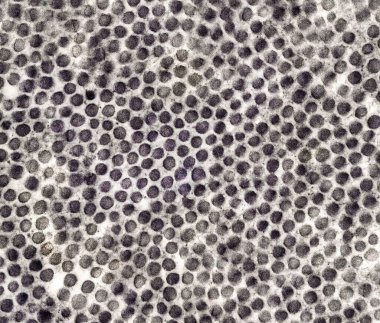 Transmission electron micrograph (TEM) of connective tissue showing cross-sectioned collagen microfibrils. clipart