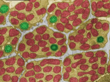 Coloured transmission electron micrograph (TEM) of cross-sectioned inner segments (ellipsoid) of photoreceptors. The region contains many mitochondria (red) and a cilium (green) that connects with the outer segment. clipart
