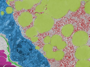 Emziren bir meme bezinin renkli iletim elektron mikrografı (TEM). Salgıdan sonra, alveol epitelyum (mavi) daha düşük kalır. Alveolar lümendeki süt salgısı lipit damlacıkları (açık sarı) ve glikojen parçacıkları (kırmızı) göstermektedir. A b