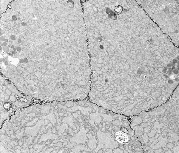 Espace Intercellulaire Étroit Entre Les Cellules Épithéliales Peut Être Rempli Photo De Stock