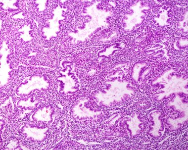 Endometriyal salgı bezleri, ışık mikrografı. Rahim döngüsünün salgılama evresinde endometrium bezleri çok genişlemiş ve bükülmüş görünüyor..