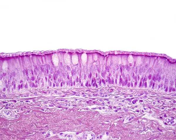 呼吸上皮 的纤毛假层柱状上皮 上皮的顶部边缘有一层纤毛 类似毛发 固定在其基部身体上 在纤毛细胞中 可以看到一些杯状细胞 免版税图库图片