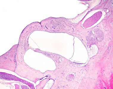 Low magnification micrograph showing, from top, cross-sectioned facial nerve, organ of Corti (left) and saccule with macula sacculi (right). clipart