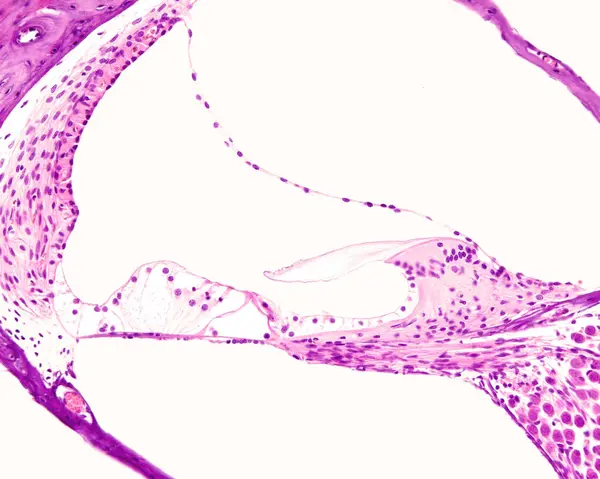 内耳耳蜗横断面的光镜 从上到下显示 耳蜗和鼓膜导管或结节 由Reissner膜和基底膜分开 耳蜗导管显示 从右到左 图库照片
