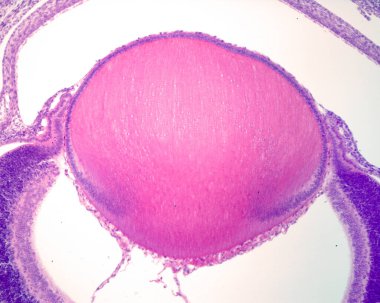 Göz merceği, ışık mikrografı. Lensin ekvatoru, mercek epitelyumundan lens liflerine geçişi gösteren gelişmekte olan bir gözde.