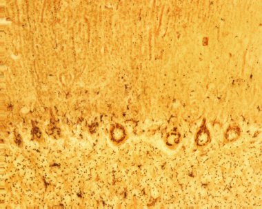 Cerebellar cortex. Purkinje cells are some of the largest neurons in the human brain. They are located within the Purkinje layer in the cerebellar cortex. The micrograph shows the large Golgi apparatus of these cells stained with the Cajal's formol-u clipart