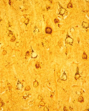 Serebral korteksin piramit nöronları Cajal formol-uranyum gümüş metoduyla lekelenmiş Golgi cihazını gösteriyor. Golgi aygıtı, piramit nöronlarının hücre gövdesinde bulunan ve çekirdeği çevreleyen siyah bir ağ olarak görülebilir.