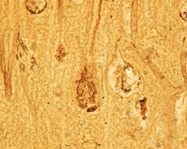 High magnification micrograph showing the Golgi apparatus in the Betz cells, the largest pyramidal neurons of the motor cerebral cortex. The Golgi apparatus appears as a black network located in the cell body surrounding the nucleus, and also spreadi clipart