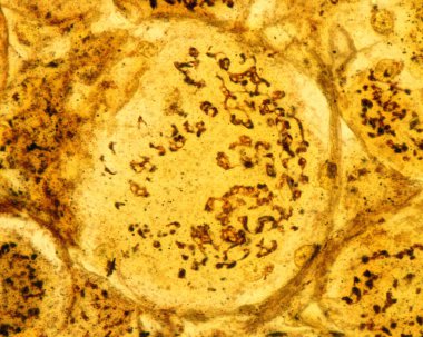 Cajal 'ın formol-uranyum gümüş metoduyla lekelenmiş sırt kök sinir hücrelerinin yüksek büyütme mikrografı Golgi aygıtını gösteriyor. Nu 'nun etrafındaki nöron hücresinde bulunan kahverengi bir ağ gibi görünüyor.
