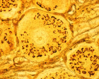 High magnification micrograph of pseudounipolar neurons of a dorsal root ganglion stained with the Cajal's formol-uranium silver method that demonstrates the Golgi apparatus. It appears as a brown network located in the neuron cell body around the nu clipart