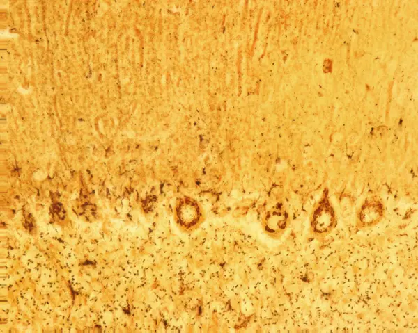 stock image Cerebellar cortex. Purkinje cells are some of the largest neurons in the human brain. They are located within the Purkinje layer in the cerebellar cortex. The micrograph shows the large Golgi apparatus of these cells stained with the Cajal's formol-u