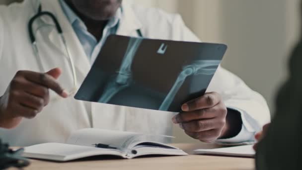 認識できない男性医師アフリカ放射線医外科医療法士骨症は 病院で外傷手術の相談を受けた患者に骨折した骨関節のMri断層撮影法のRoentgenをX線スキャン結果を示しています — ストック動画