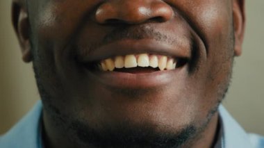 Kısmen insan yüzü tanınmayan Afro-Amerikan etnik erkek modeli. Tıbbi diş hekimliğinin koyu tenli müşterisi. Ağız dudakları gülüyor.