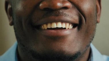 Close up part human face unrecognizable african american ethnic man model with dark skin client of medical oral dentistry male mouth lips smiling white dental toothy healthy smile laughing teeth care