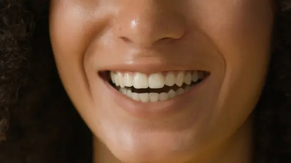 Close up female lips unrecognizable woman beauty face in details white healthy toothy smile dental care happy laughing ethnic African American girl smiling dentistry oral care whitening teeth veneers