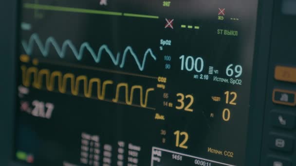 Lékařské Vybavení Nemocnici Moderní Monitor Tepové Frekvence Operačním Sále Displej — Stock video