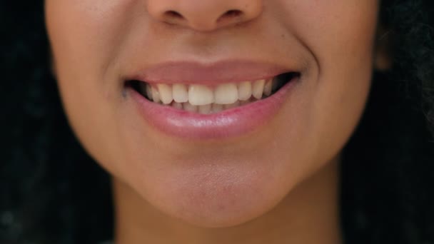Close Gelukkig Afro Amerikaanse Vrouw Mooie Lippen Mond Tand Tandheelkundige — Stockvideo