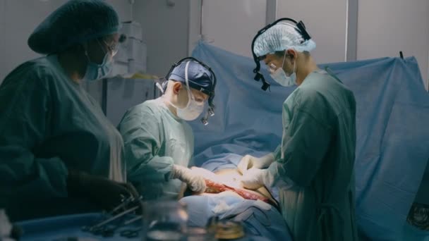 Professionelle Kirurger Læger Med Hjælpe Sygeplejerske Udføre Kirurgisk Operation Intensiv – Stock-video